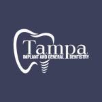 Tampa Implant General Dentistry